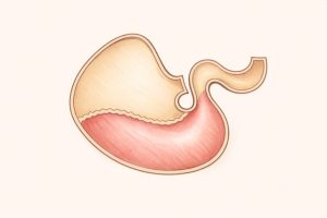 Illustration of the equine stomach showing the upper squamous region and lower glandular region, highlighting the areas involved in equine gastric ulcer disease.